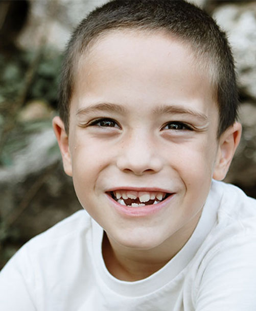 ortodoncia para niños integrativa tratamiento
