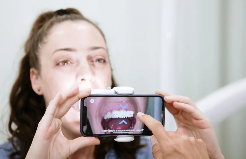 Beneficios del Dental Monitoring